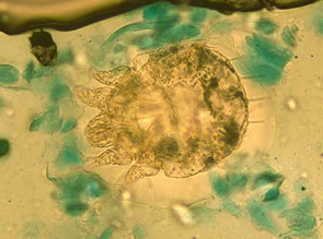 Scabies Mite Anatomy